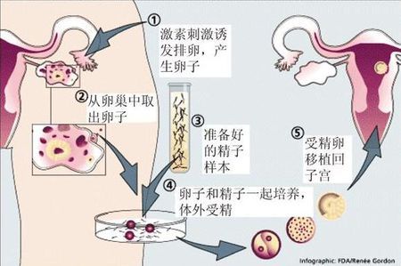 试管代怀公司生殖中心